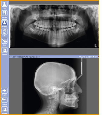 Image Planmeca Romexis